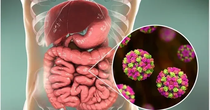 Yeni norovirus dalğası