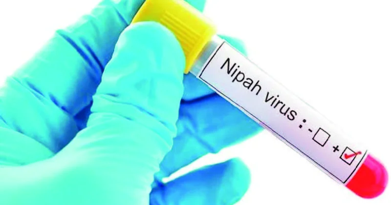 Nipah virusu Hindistandan yol gəlir...