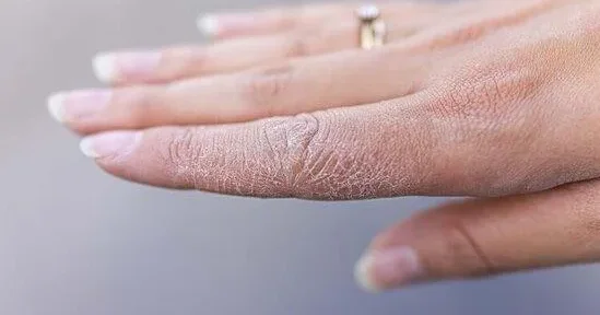 Dərimiz niyə pulcuqlanır, qaşınır? AÇIQLAMA