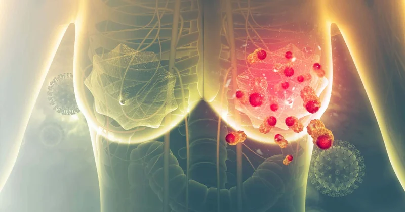 Süd vəzi xərçəngi xəstələrində Venadaxili vitamin C nin təsiri