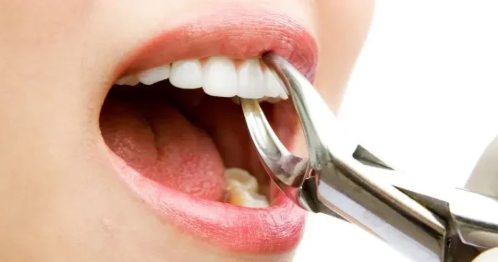 Stomatoloq qadının 11 sağlam dişini ÇIXARDI