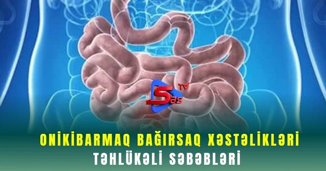 Onikibarmaq bağırsaq xəstəlikləri Təhlükəli Səbəbləri