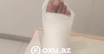 Sabunçu xəstəxanasında BİABIRÇILIQ: Dedilər ki, gipsi və binti özün al VİDEO
