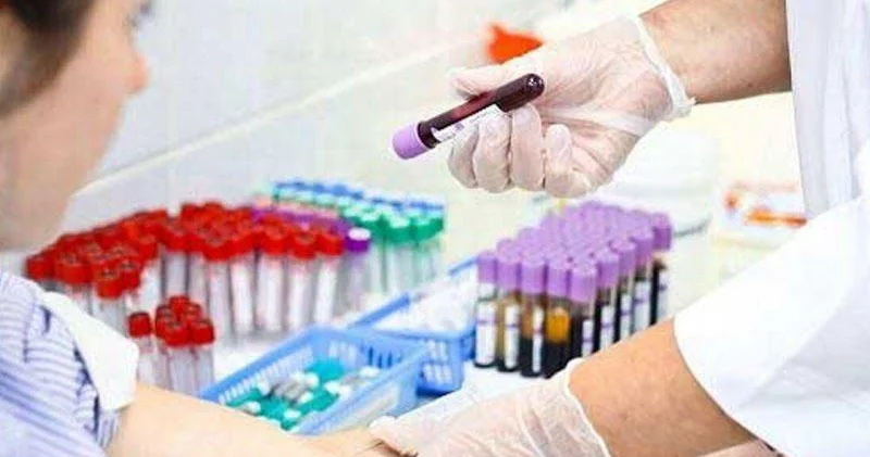 Bu il hepatit diaqnozu qoyulanların sayı AÇIQLANDI