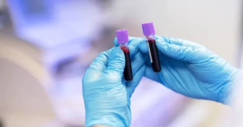 Vazopressin nədir? Kişilərdə vazopressin hormonu