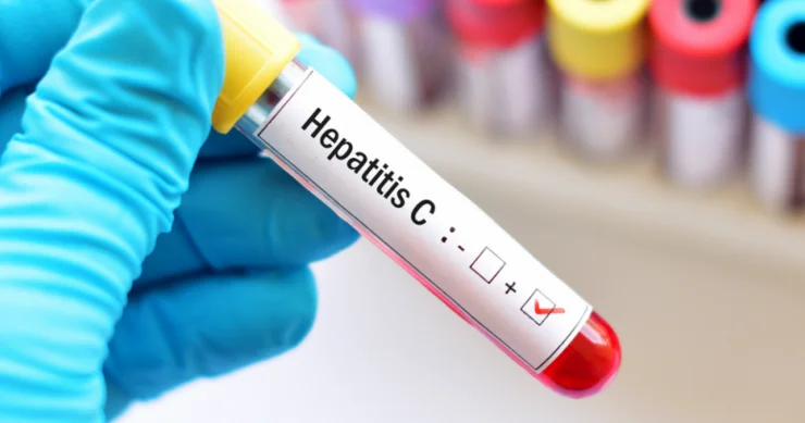 Azərbaycanda hepatit statistikası Son rəqəmlər