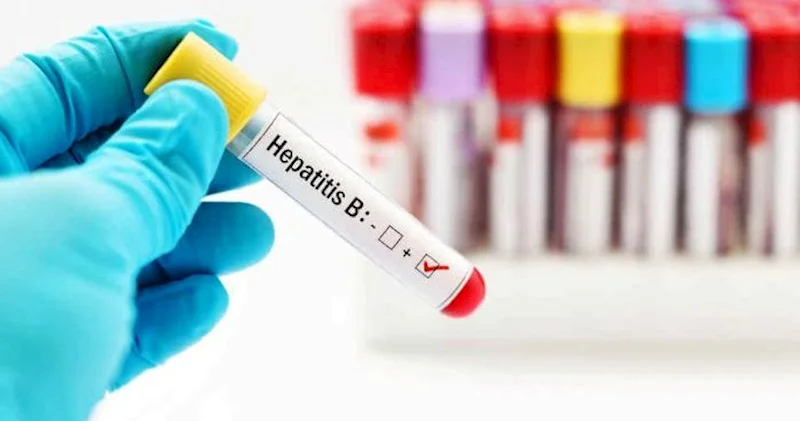İlin ilk altı ayında hepatit B və C diaqnozu ilə neçə nəfər qeydiyyata alınıb?