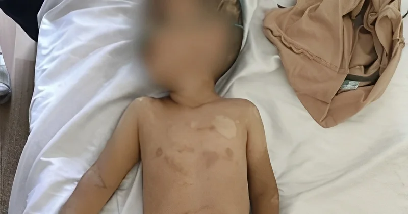 Atası tərəfindən vəhşicəsinə döyülən körpənin anası: Mənim əl qolumu bağlamışdı
