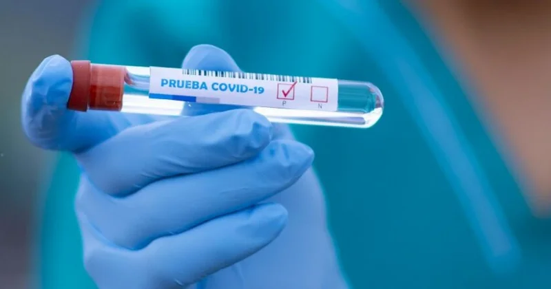 İspaniyada qrip və COVID 19 epidemiyası: Ölənlər var
