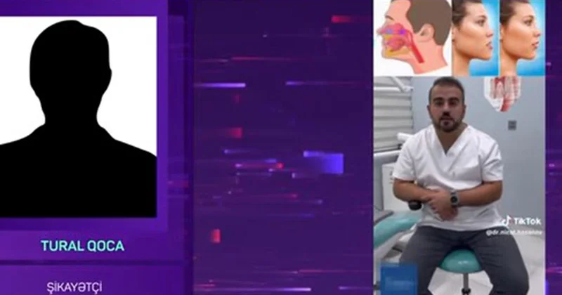 500 manat ziyana düşdü, az qaldı ölsün “TikTok Stomatoloqu” barəsində AĞIR İDDİA VİDEO