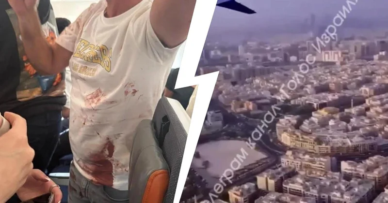 Pilotların dava etdiyi həmin təyyarədən ilk Görüntülər