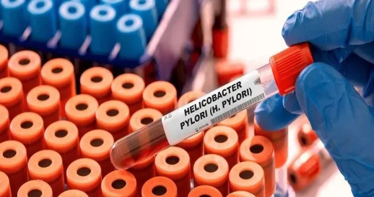 Hər il 2 milyondan çox yeni xərçəng halı beş infeksiya ilə əlaqəlidir ARAŞDIRMA