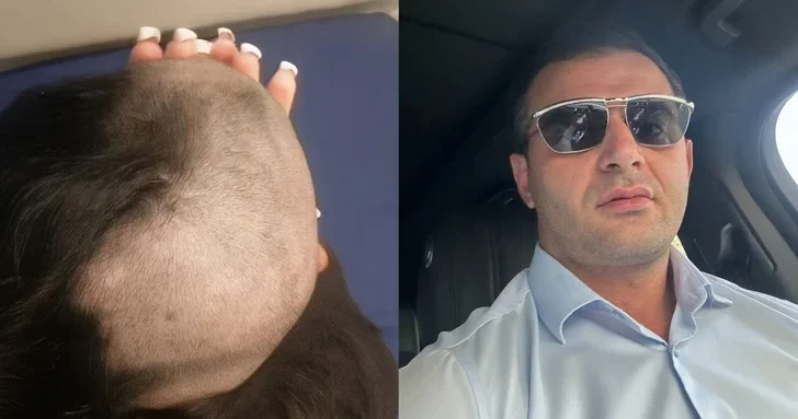 В Баку арестован мужчина, издевавшийся над женой