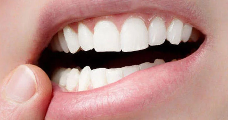 Diş itkisi ölüm riskini artıra bilər ARAŞDIRMA