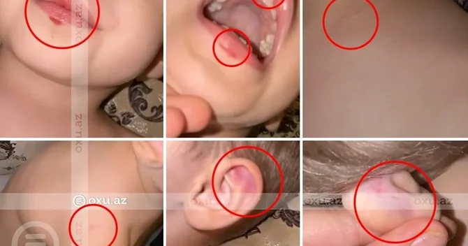 İnci körpələr evində azyaşlıya şiddət iddiası: Mama, ak elədilər