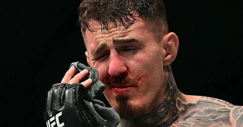 Tom Aspinallın ciddi göz zədəsi təsdiqləndi