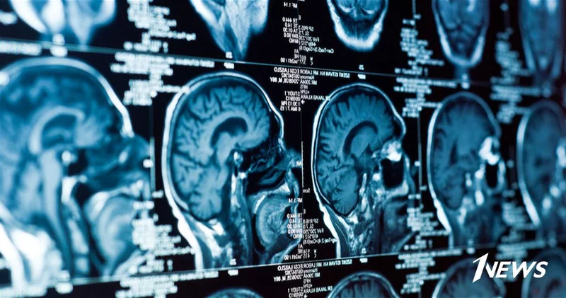 Назван главный ген, управляющий развитием мозга