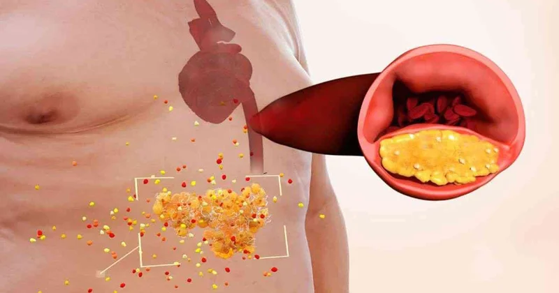 Kimlərdə daxili orqanlar piylənir? Diqqət