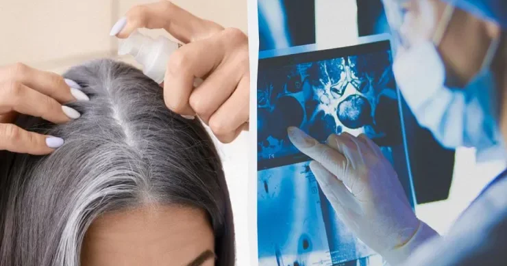 Ağ saçlara görə narahat olmayın: Saçların qocalmasının gözlənilməz funksiyası kəşf edildi