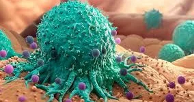 Onkologiyanın müalicəsində effektiv ikili