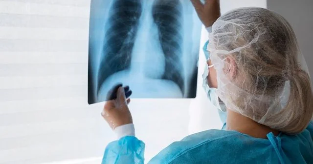 В Великобритании зафиксирован резкий рост заболеваемости туберкулезом