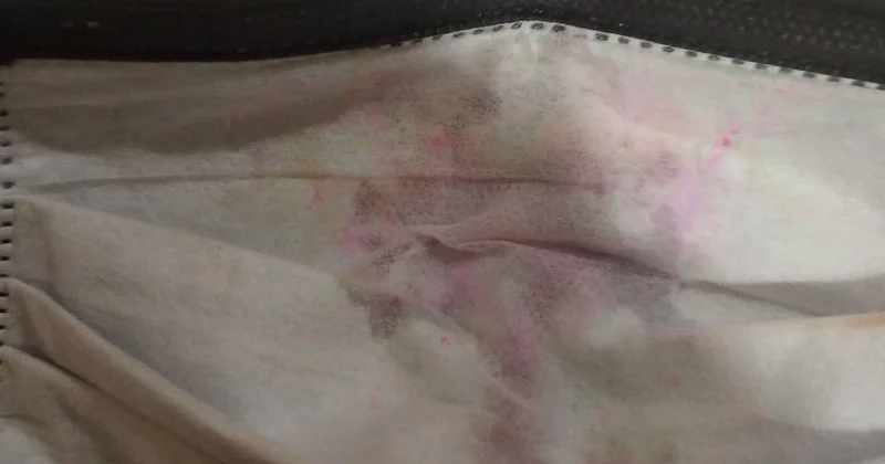 Bakıda xəstəlik yayan tibbi maskalar satılır? İDDİA