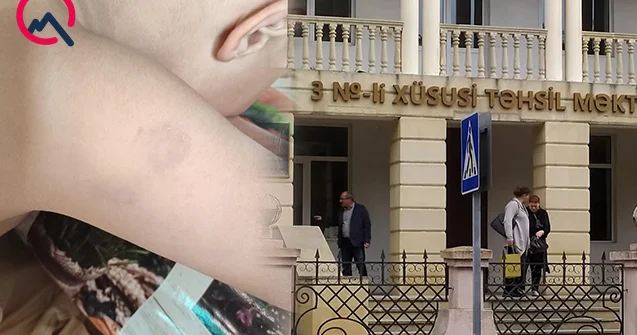 Xüsusi məktəbdə müəllim azyaşlıya şiddət göstərib? Rəsmi açıqlama Foto