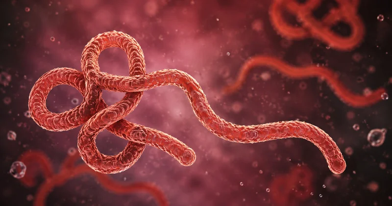Daha bir ölkədə Ebola həyəcanı