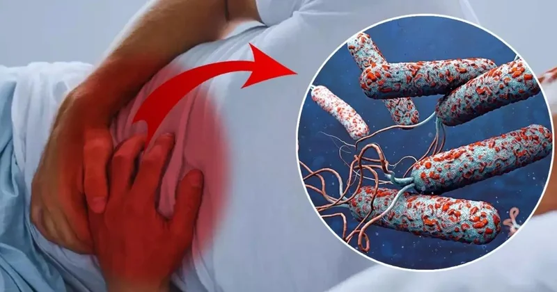31 ölkədə xolera alarmı Ölənlərin sayı sürətlə artır