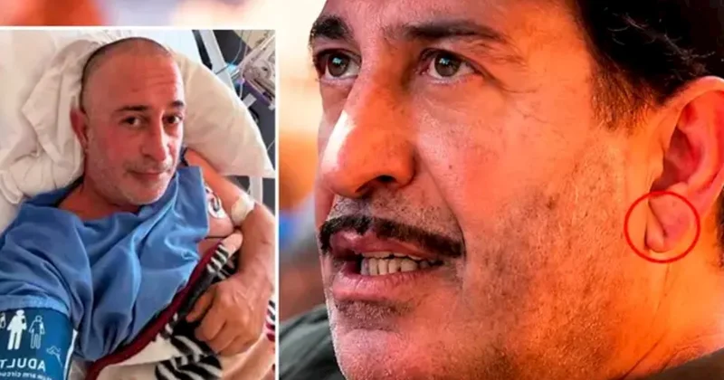 Cem Yılmazın qulağındakı xətt diqqət çəkdi: Frank əlaməti infarktın xəbərçisidir?
