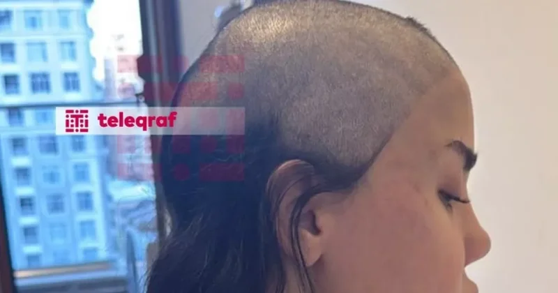 Мужчине, обрившему голову избитой жене в Баку, предъявлено обвинение ФОТО