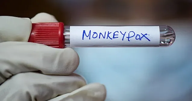 ÜST dən meymunçiçəyi ilə bağlı XƏBƏRDARLIQ