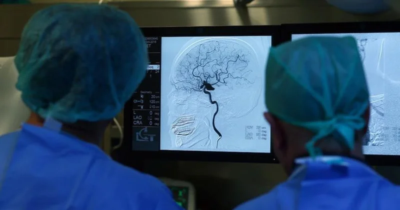 Həkimdən insultla bağlı xəbərdarlıq "Gənclər arasında çox yayılıb"