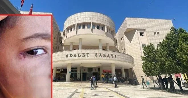 Şagirdin üzərində siqaret söndürən təmizlik işçisi həbs olunub